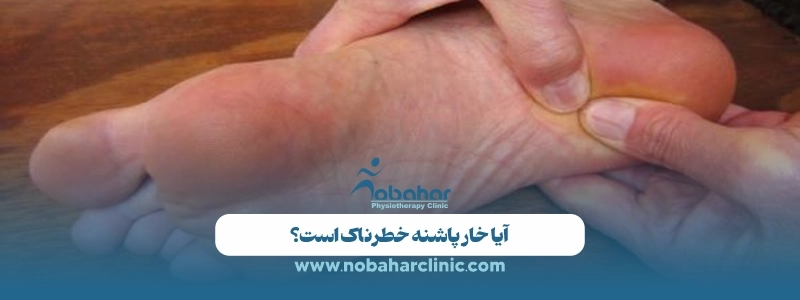 خار پاشنه از کجا میآید و چه زمانی باید جدی گرفته شود؟ 3 آیا خار پاشنه خطرناک است؟