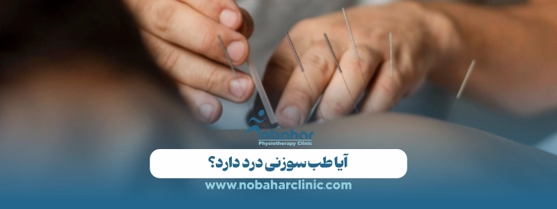 طب سوزنی چیست؟ کاربرد، مزایا، عوارض و روش انجام 3 آیا طب سوزنی درد دارد؟
