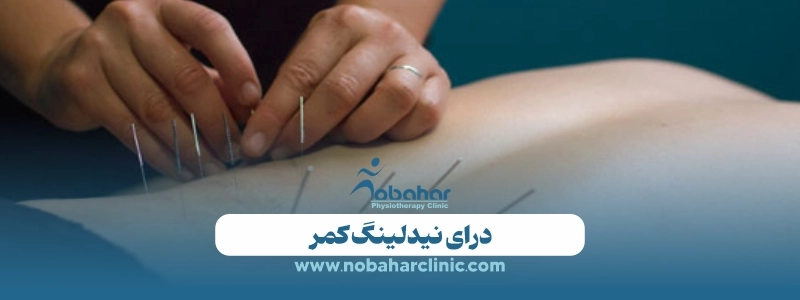 درای نیدلینگ (سوزن خشک) چیست؟ مزایا، کاربرد و هزینه 3 درای نیدلینگ کمر
