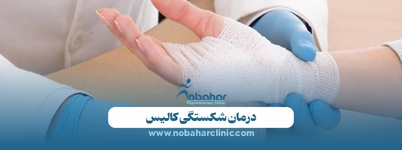 شکستگی کالیس: علل، درمان و فیزیوتراپی برای بهبود سریعتر 2 درمان شکستگی کالیس