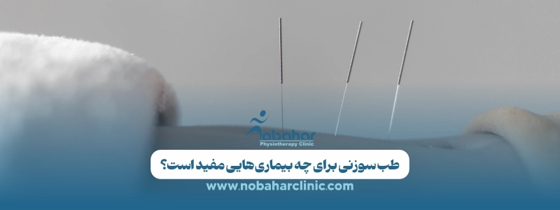 طب سوزنی چیست؟ کاربرد، مزایا، عوارض و روش انجام 1 طب سوزنی برای چه بیماری_هایی مفید است؟