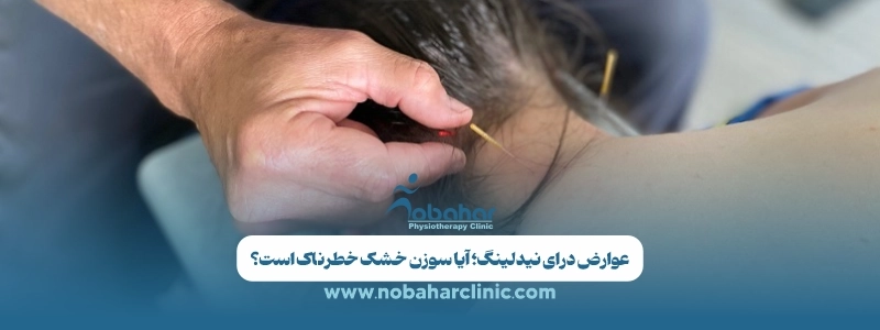 درای نیدلینگ (سوزن خشک) چیست؟ مزایا، کاربرد و هزینه 4 عوارض درای نیدلینگ آیا سوزن خشک خطرناک است؟