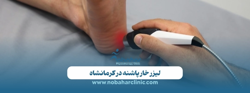 بهترین دکتر خار پاشنه در کرمانشاه 3 لیزر خار پاشنه در کرمانشاه
