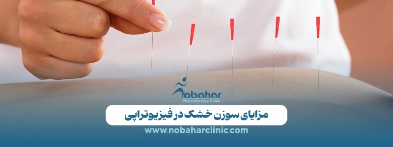 درای نیدلینگ (سوزن خشک) چیست؟ مزایا، کاربرد و هزینه 2 مزایای سوزن خشک در فیزیوتراپی